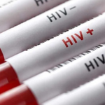 HIV fonları 2,1 milyar dolar eridi: Uzmanlardan AIDS salgını uyarısı