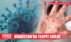 Mpox virüsünün yeni varyantı Hindistan'da tespit edildi