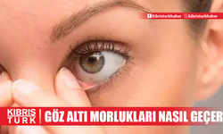 Göz altı morlukları nedir, neden olur ve nasıl geçer? Geçmeyen göz altı morluklarına ne iyi gelir?