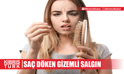 Saç döken gizemli salgın: 155 kişi aniden kel kaldı