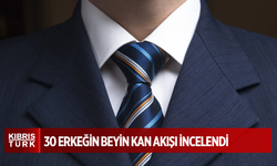 Beyin sağlığını seven kravat takarken iki kere düşünsün! İşte çarpıcı araştırma