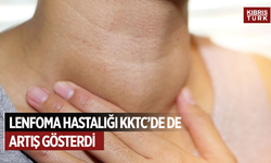 Özkayalar: Lenfoma hastalığı KKTC’de de artış gösterdi