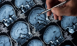 Zayıflama iğnelerinin Alzheimer'ın ilerlemesini yavaşlattığı bulundu