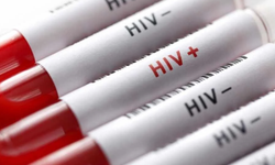 Biyologlar Derneği AIDS Günü dolayısıyla açıklama yaptı: Sürdürülebilir bir HIV politikası oluşturulması gerekiyor