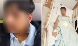 Sırasına oturdu diye arkadaşının çenesini kırdı!