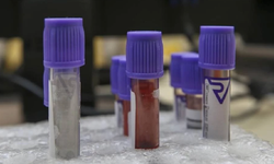 Yeni kan testi, ölümcül kanser hastalarına umut olabilir