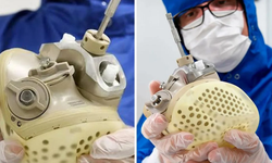 Kalp Yetmezliği Tedavisinde Umut Veren Buluş