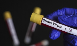 DSÖ'den Ebola Uyarısı