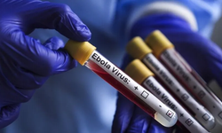 Ebola’da Can Kaybı 1405 oldu
