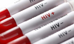 HIV fonları 2,1 milyar dolar eridi: Uzmanlardan AIDS salgını uyarısı