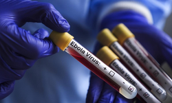 KDC’de Ebola: Can Kaybı 3 Bin 95