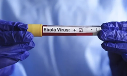 Kenya'da Ebola vakası sayısı 8'e yükseldi