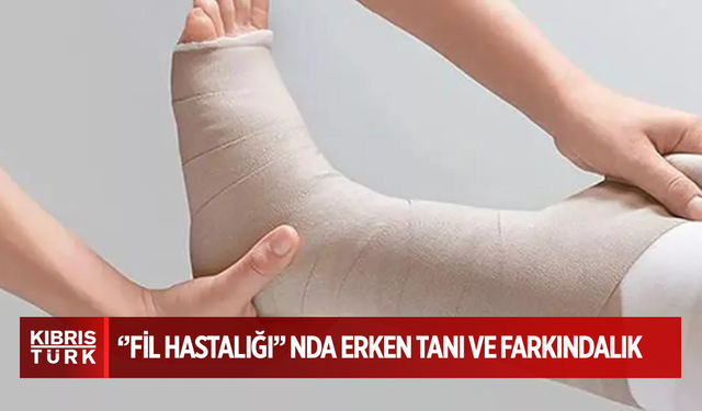 6 Mart Dünya Lenfödem Farkındalık Günü