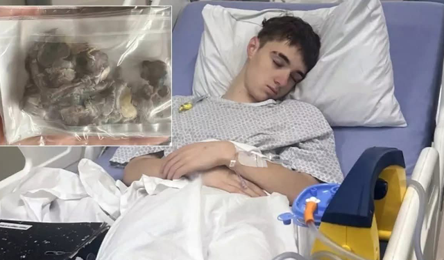 17 Yaşındaki Genç Elektronik Sigara Nedeniyle Akciğer Ameliyatı Oldu