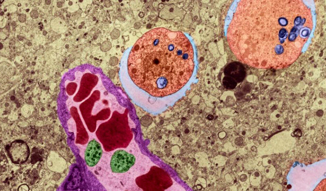 Serbest Yaşayan Amipler Sağlığı Tehdit Ediyor