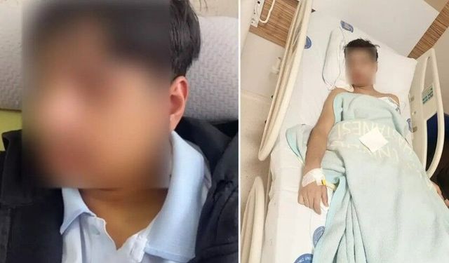 Sırasına oturdu diye arkadaşının çenesini kırdı!