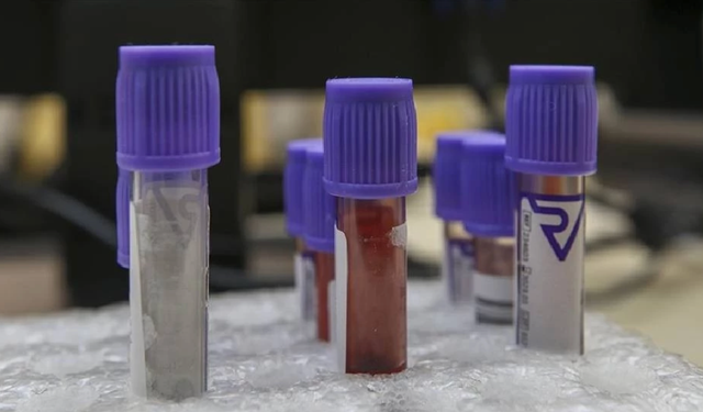 Yeni kan testi, ölümcül kanser hastalarına umut olabilir