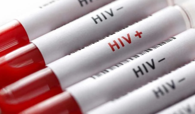 HIV fonları 2,1 milyar dolar eridi: Uzmanlardan AIDS salgını uyarısı