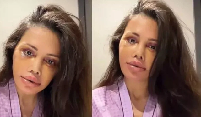 Didem Ceran'dan yeni operasyon açıklaması: Kim Kardashian estetiği yaptıracağım