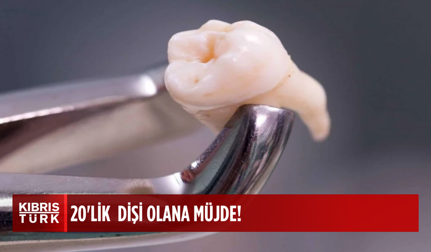 20'lik dişleri olan yaşadı: Servete dönüşüyor...