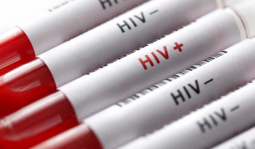 Biyologlar Derneği AIDS Günü dolayısıyla açıklama yaptı: Sürdürülebilir bir HIV politikası oluşturulması gerekiyor