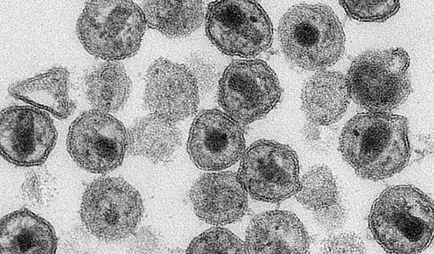 Dirençli bakterilere karşı yeni antibiyotik üretildi