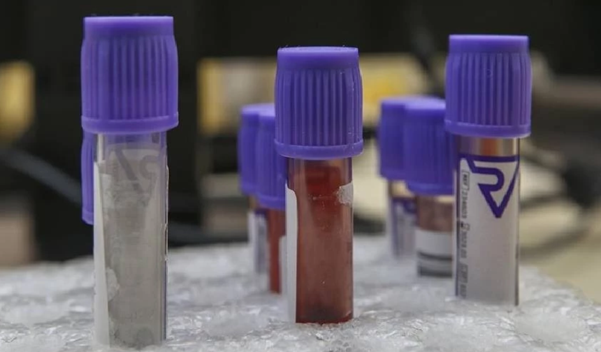Evde yapılan test, mesane kanserini yüzde 90 doğrulukla tespit ediyor