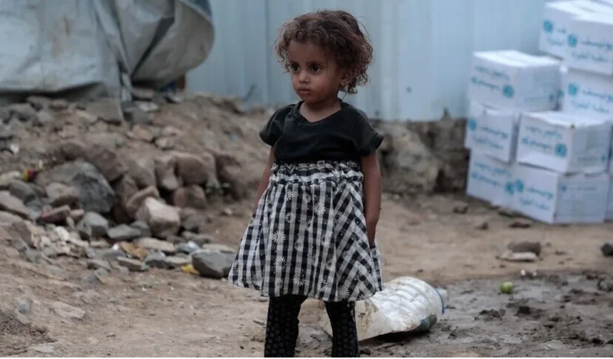 UNICEF: Yemen'de 5 yaş altı 2,2 milyon çocuk, akut yetersiz beslenme sorunu yaşıyor