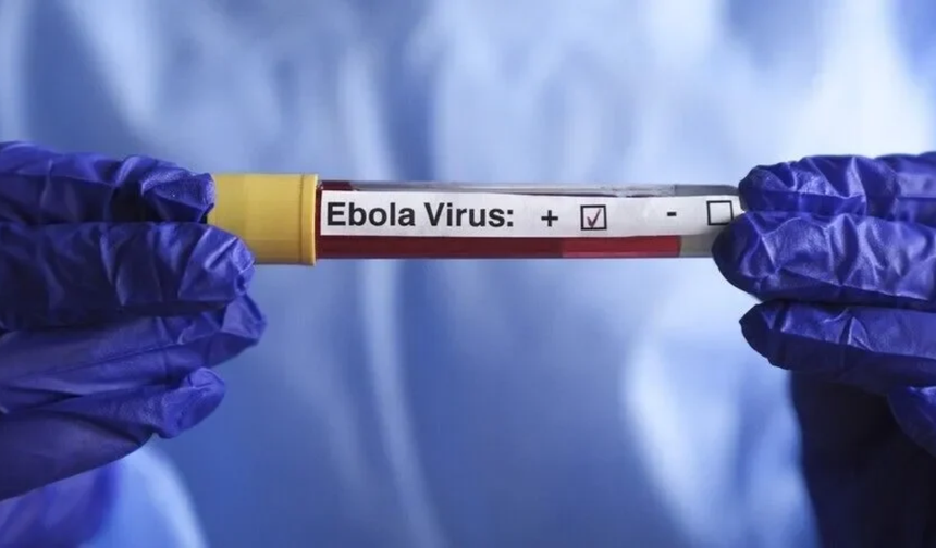 Kenya'da Ebola vakası sayısı 8'e yükseldi