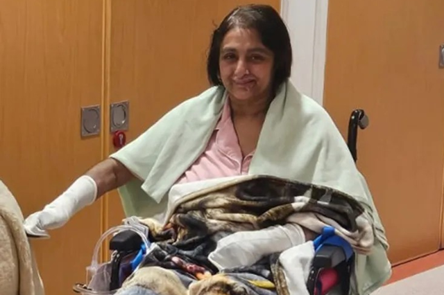 Bir Kopek Yalamasi Hayatini Karartti Dort Uzvunu 19590566 3084 M